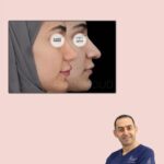 Huda Husain Instagram - دكتور محمد حمود وعملية جفوني القادمه بتكون معاه في عيادة بيوتي كلينك @beautyclinick