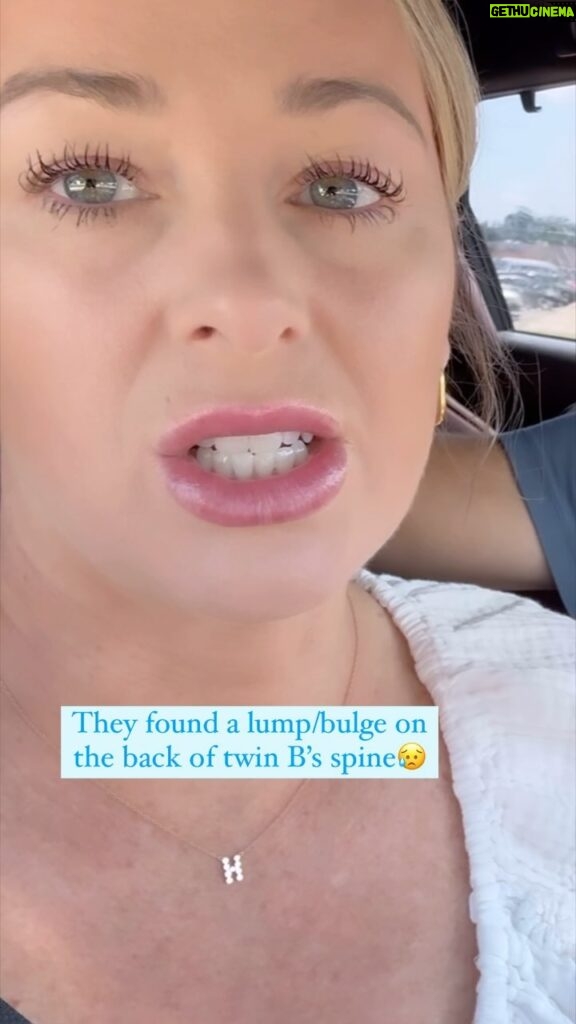 Jamie Otis Instagram - I was terrified going into this ultrasound with the high risk doc today. Last week we saw the “bump” on twin b’s spine and then I googled what it could be ...which told me all sorts of issues the baby could have.😩😢 We went to get pizza after the appointment and I was crying. My daughter looked at me and said, “Mommy don’t worry about baby B.” She poured a circular round of Parmesan cheese on her plate with a smaller circle off the back. She flicked the smaller bump away and said, “in a week that bump will be gone!” The next day I was crying again and she said, “mommy what did I tell you?!” She motioned the flicking again & said”The bump will be gone in a week!” Today marks a week and we have our second ultrasound. Over the last week I’ve held on to hope that God can work miracles. I’ve prayed non stop for both of these twins. …and I remember every single one of the stories shared with me saying you had an ultrasound that seemed ominous but then it turned out to be ok. I kept praying that would be our story today.🙏 I have to thank every single one of you - from the bottom of my heart - for all your words of encouragement, love & support. It means the whole world to me.🙏🙏🙏 I promised God I’d give him all the glory - regardless of the outcome (but I begged him for two healthy babies at our ultrasound today)! As promised, we are documenting our full journey with the twins on our YouTube channel, Hanging With The Hehners! The full video is live on our YouTube channel now! Link in bio & stories!❤️ Thank you again for all your love & support and prayers!! #bestfrans 💕