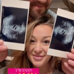 Jamie Otis Instagram – I was diagnosed with infertility after my second baby – it didn’t make sense since I’ve already had children. I decided to do everything I could to try to help myself.💪🤰❤️

I quit drinking alcohol & my daily pot of coffee. I switched to green tea and began incorporating more fruits and veggies in my diet. I cut waaaay back on the processed junk I was eating and I tried to avoid too much dairy and too much gluten (never successfully gave up either 100% bc TBH, I still “cheat” all the time)🤪😝

I got a gym membership and began going as much as I could. At first I could barely do the jump rope bc I was so out of shape, but slowly I began doing 1 then 2 then a dozen pushups *on my toes* — so proud of that 😜💪

We would go to church and pray for God’s will to be done with our family …& then tried our best to truly BELIEVE it would be.🙏

I began meditating every👏single👏night👏

….I know this isn’t always the answer for those who struggle with fertility (and it still took us a loooong time to get that positive test) but I figured I’d share what I did that I think was somewhat helpful bc I know the fertility journey is so isolating and lonely — especially when it’s secondary infertility and if you even mention wanting more kids it’s assumed you don’t appreciate the ones you already have.🤦🏼‍♀️

If your heart is aching for a child and you’ve been told you can’t have one, I’m so sorry. It’s a pain that pierces your soul and not a lot of people understand.😔

I found going to the fertility doctor was so helpful to find out what I could about what was “wrong” w me and then I found it so helpful to try to change my lifestyle to see if it’d help.🤷🏼‍♀️

We are now pregnant WITH TWINS. I didn’t have any fertility meds or treatment … these babies came to us spontaneously!🙏🙏🙏

I wanted to share this in hopes it can give someone who’s been on the same trying to conceive struggle bus some  HOPE.🙏

My heart goes out to those of you struggling with growing your family…I’m sending you so so so much love & lots of sticky baby dust.❤️