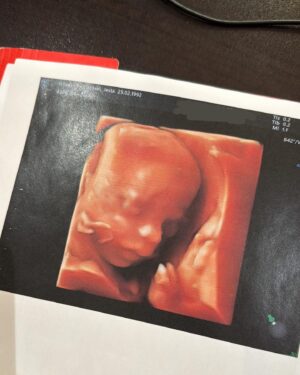 Jesta Hillmann Instagram - T2 morphologie et je dois vous annoncer QUE TOUT VA BIEN 🥹🤍 Il n’y a plus d’hématomes et bébé va super bien, il grandit parfaitement et se développe à merveille 🙏🏼