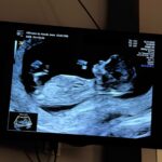 Jesta Hillmann Instagram - J’étais tellement pressé de savoir si j’étais enceinte que j’avais fais des tests bien trop tôt qui m’indiquaient tous négatif. J’avais dis à Benoît que ça n’avait pas marché cette fois ci dès le premier essai.. 2 jours plus tard, un soir je décide de faire un dernier test car mon corps me disait le contraire.. et paf ! Même si je suis tombé enceinte directement après l’arrêt de la contraception c’était finalement une surprise de voir cette très très fine et légère deuxième barres qu’on espérait tant 🥹🙏🏼 C’était voulu et très rapide mais du coup l’émotion fut intense 🤍