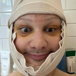 Jinkx Monsoon Instagram - 2024 so far, in a nutshell. 

Having the ability to have Facial Feminization Surgery is a privilege. Living somewhere where I can easily access HRT and other gender affirming care, is a privilege. These are privileges I have not taken lightly, especially at this time. 

Last year, while on tour, a trans elder told me: “Jinkx, it’s never too late.” She was right. But let me say, “it’s never too late” means the world to someone still figuring out their path. Also, “it’s never too late” means something different for all of us. 

I know we don’t all have the same privileges and the same access to care. I will continue to use my voice til the day I die to fight for everyone, everywhere who is worried that it’s “too late.” We all find our path. We all find our time. You do you, however you want to do you, whenever you can— it’s never too late.