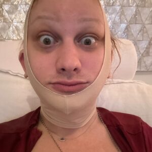 Jinkx Monsoon Instagram - 2024 so far, in a nutshell. 

Having the ability to have Facial Feminization Surgery is a privilege. Living somewhere where I can easily access HRT and other gender affirming care, is a privilege. These are privileges I have not taken lightly, especially at this time. 

Last year, while on tour, a trans elder told me: “Jinkx, it’s never too late.” She was right. But let me say, “it’s never too late” means the world to someone still figuring out their path. Also, “it’s never too late” means something different for all of us. 

I know we don’t all have the same privileges and the same access to care. I will continue to use my voice til the day I die to fight for everyone, everywhere who is worried that it’s “too late.” We all find our path. We all find our time. You do you, however you want to do you, whenever you can— it’s never too late.