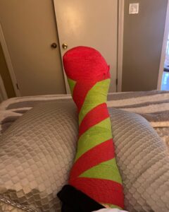 Jodie Sweetin Instagram - If you’re going to have foot surgery over the holidays (planned this time, not an accident), at the very LEAST make sure they wrap you up and make you look festive!! If you need me… my Candy Cane foot and I will be laying in bed watching Christmas movies, doing puzzles and really leaning into being an old lady for a few weeks!