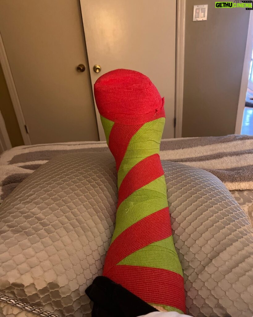 Jodie Sweetin Instagram - If you’re going to have foot surgery over the holidays (planned this time, not an accident), at the very LEAST make sure they wrap you up and make you look festive!! If you need me… my Candy Cane foot and I will be laying in bed watching Christmas movies, doing puzzles and really leaning into being an old lady for a few weeks!