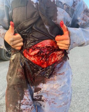 Karen Fukuhara Instagram - Season 3 Episode 4 after @jensenackles blasted the shit outta me 😂 

Props to our prosthetics team! Always incredible work from face peels to pumping blood. More to come in season 4!