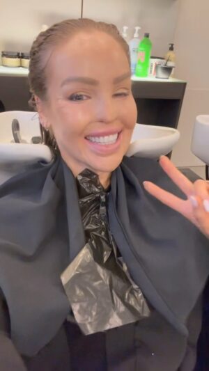 Katie Piper Thumbnail - 8K Likes - Top Liked Instagram Posts and Photos