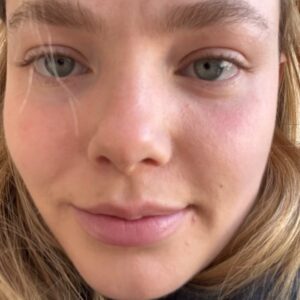 Kristine Froseth Instagram - in a world….where we treat physical illness and mental illness the same …..!?!!? 🙀