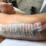 Lindsey Vonn Instagram - I’ve been bruised and broken but I’ve always come out the other side a better person. No matter how many times I fell, I always got back up. I didn’t do it alone though. I am so thankful to have had the support of friends, family and you guys, my fans. Knowing I had people supporting me helped me in my darkest hours. Every day I tried to put one foot in front of the other until it eventually got me back to where I wanted to go… which was usually the top of the mountain 🏔️ 😍 We are all on our own paths, but if you’re injured or going through a hard time, believe in yourself and know that you will come out of it a better and stronger person. You got this 💪🏻