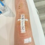 Lindsey Vonn Instagram - After a lot of thought, research and talking to many many doctors, I made the decision to get a knee replacement. I have severe tri-compartment degeneration but the main compartment that has been painful is the lateral compartment, or the outside of my knee. My doctor for many of my surgeries, Dr Hackett, and I did a preparation surgery last July to try to slow down the need for the replacement but also preparing other parts of my knee for the inevitable. But I got to the point where it was too much and my knee could not handle doing the things I love to do. So Dr. Roche did a Mako Robot assisted lateral unicompartmental replacement. In other words, they cut off part of my bone and replaced it with titanium pieces. *in pic 2 Dr Roche and his team did an incredible job and I’m recovering well. I hope this helps me lead the active life I’ve always wanted. Appreciate all of the well wishes🙏🏻 Means a lot to me. But don’t worry, this is just another bump in the road in my journey through life and you know I’ll be back up and running asap 💪🏻 can’t hold me down for long! 🙏🏻❤️