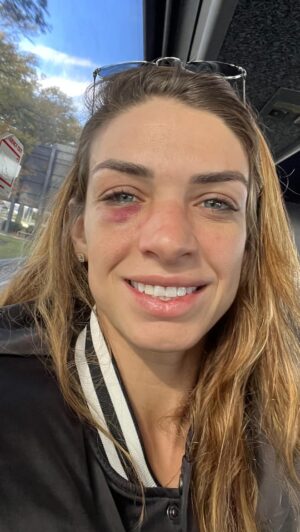 Mackenzie Dern Thumbnail - 99.3K Likes - Top Liked Instagram Posts and Photos