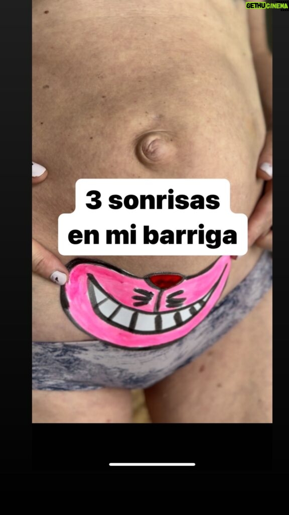 María Castro Instagram - Esta cicatriz me pilla con experiencia. Siempre pensaré que la huella de mi cesárea en mi piel, es como una sonrisa… la sonrisa más bonita que me hayan podido “dibujar” jamás… Y es que mis hijas decidieron salir por la puerta grande, y no iba a ser yo la q les dijese que no podían hacerlo… porque obviamente, aunque hubiese preferido que las tres hubiesen nacido por “donde tocaba”, no teniendo posibilidades de elegir, lo importante era llegar… y aquí están!!!!! Y una vez aquí, y mientras una distinta y tamb se agota jajajaja, tenía q dejarme un “hueco” para que la sonrisa de la tripa luciese lo más bonita posible. Y como? Pues con eficacia y sobre todo cómoda y fácilmente con @trofolastin Cicatrices, que reduce de forma visible las cicatrices hipertróficas y queloides, en tan solo 8 semanas. Ojalá lo hubiese sabido con Maia, que se me formó un queloide de 10 cm de largo y 1 de grosor, que empezó a desaparecer a los tres años de dar a luz…. TRES AÑOS!!!! Con Oli no me pillo ya desprevenida y con Emma repito experiencia. Porque lo q funciona no lo cambio, y encima recorto el parche, me lo coloco y hasta que pasan unos 7 días, ni me acuerdo… pudiéndome duchar igual, e incluso tomar el sol, porque tienen protección. Pues hala, tod@s a la farmacia… no vayáis a decir luego que no os avisé! #publi