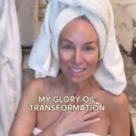 Margaret Josephs Instagram - My Glory Oil transformation!! My girls 🍈🍈 needed a little boob tape 😝 for an event but the aftermath was not good! Watch to see how the @ecotan Glory Oil completely healed my scar in a week! It has its name for a reason 🙌🏻🙌🏻🙌🏻 Cruelty free, organic, & Australian made 💕