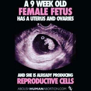 Mia Dinoto Instagram - Enough with the euphemisms. If you support killing babies, just say it. Abortion is murder and that’s a fact. Facts don’t care about your feelings so whatever emotional excuse you have for killing babies doesn’t matter because it’s NEVER ok to kill an innocent human life. - #TurnToJesus #memes #memesdaily