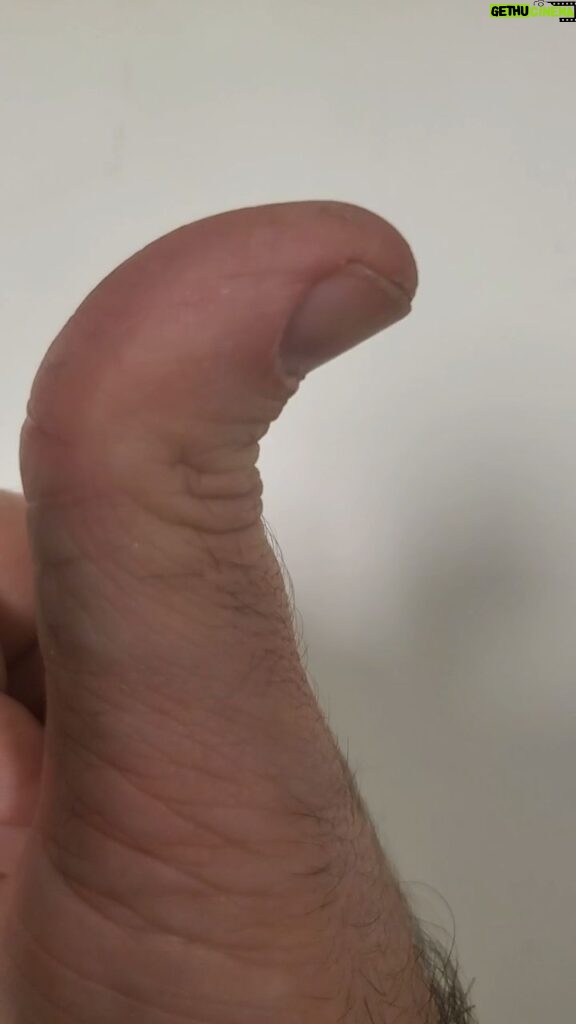 Michael Stevens Instagram - Hitchhiker's Thumb #anatomy #thumb #hyperextensibility #distal #phalanges #fingers #bones #hand #pedropascal #adele #jessicalaba #michaelstevens #etymology #bend #backwards