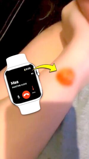 Mikhail Varshavski Instagram - Apple Watch Users, Beware! #applewatch #skincare