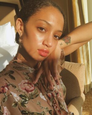 Samantha Logan Instagram - dreaming of when my skin wasn’t freaking the fuck out 👍🏽👍🏽👍🏽