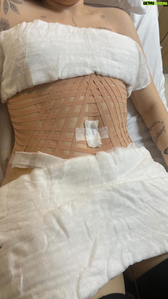 Solange Gomes Instagram - Parte 1 . Etapas. Abdominoplastia com lipo @stephaniegomees Cirurgião plástico @davidsimiss Em breve, resultado pra vocês. #cirurgiaplastica