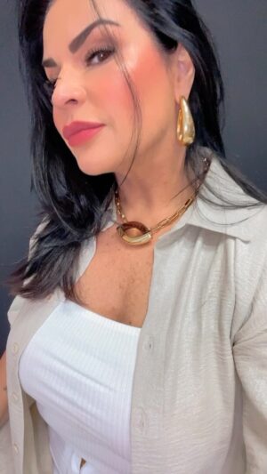 Solange Gomes Instagram - Vem ver como ficou o resultado do meu pescoço após procedimento com a toxina botulínica a @dra.crispessoa #solangevaifazer50 🙀