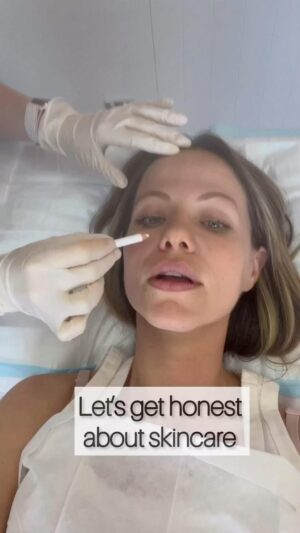 Tammin Sursok Instagram - I truly believe that we need to make disclaimers mandatory on social posts that claim ONLY skincare makes the difference in skin aging/ pigmentation, skin resurfacing, etc. There is a whole other side to the skincare industry that I’m sure we are all familiar with. Laser, peels, injectables, skin tightening treatments and so much more. 
I believe that without these disclaimers, we compare ourselves to unrealistic “natural” beauty standards that aren’t… natural. I’m a huge advocate of good skincare and I’ve been very invested since I was 17 BUT many of us aren’t just relying on that. So let’s get real, let’s get honest and let’s unvail the truth! 

Treatments and med spas I love! 
1- @theclinicbondi for ultra therapy which tightens skin and helps to boost collagen 
2- @hi_finch for microneedling and broad band light. Helps tighten skin, reduce sun spots, helps with pigmentation and resurfaces the skin
3- @simonourianmd1 for cool laser which resurfaces the skin

#skintreatment #ultratherapy #morpheus8 #microneedling #laser #skincare