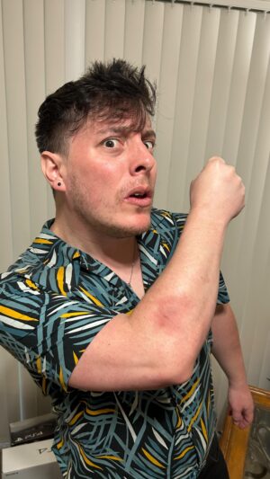 Thomas Sanders Instagram - Not a big deal 🐍 (W/ @quildarling & @domgoldofficial; & help by @lovelyyuniverse) #comedy #relatable #snake #bite #metalgearsolid