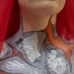 Toñi Moreno Instagram - ¡Hola gente maravillosa! ¿Os acordáis del misterio de las personas maquilladas caminando por las calles de Madrid? ¡Os cuento! Todo era una campaña de concienciación de @boehringeres sobre la #psoriasis pustulosa generalizada (PPG). Puede que no hayáis escuchado hablar de ella, es una enfermedad dermatológica crónica y rara que afecta a 13 personas por millón en España. La PPG se manifiesta en brotes de pústulas (pequeñas ampollas de pus no infecciosas) que aparecen de forma repentina y afectan al día a día de las personas que la padecen no solo física, sino también emocionalmente. Es por eso por lo que estas dos personas han querido poner el foco en este dolor físico y el aislamiento que pueden sentir. Os invito a que entréis en el perfil de @boehringeres para conocer la campaña #PielesQueMarcan y saber más sobre los síntomas de la PPG. #ad