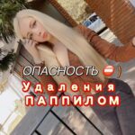 Valeria Lukyanova Instagram - Зрелище не для слабонервных! Как удалить папиллому в домашних условиях! Советы из интернета порой наносят нам вред , и могут вызвать большие проблемы , поэтому необходимо обращаться к квалифицированному специалисту у которого большой опыт работы! Ко мне обратился человек который сжег себе кожу посоветую доктора Берга при уничтожении папиломы в домашних условиях! Обычно это происходит просто : перевязал ниткой папиному , помазал специальным раствором - она отпала и никаких проблем! Именно по такому совету я удалила свои папилломы и у меня все было в порядке! Но необходимо учитывать очаг , если он находится в подмышечной впадине или та. где потеете - совершенно другой вопрос! Все заботящиеся о здоровье люди знают , что папилома и родинка - это опасность онкологии в будущем и от этого нужно избавляться незамедлительно! Внизу у нас под папиломой или родинкой многоветвистые пути мицелия, и уничтожив очаг - мицелий постепенно отмирает ! Но стоит учитывать важную вещь: всё это нужно делать со специалистом и под присмотром паразитолога! Т к данная ткань поражена грибком , из-за этого регенерация снижена на 80 % и это все очень медленно заживает и нужно понимать , чем это нужно обрабатывать , чтобы не нанести непоправимый вред! Продолжение истории и чем все закончилось читайте в моей группе по ссылке в профиле! ⛔️ расскажите у вас были такие случаи и чем все закончилось , поделитесь? #паппилома #родинки #грибок #мицелий #паразиты #паразитоз #удалениепаппилом #удалениепаппиломы #грибки #паразитология #микробиолог