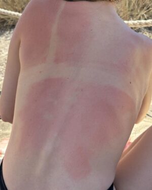 Vitória Falcão Instagram - 28 anos passando do ponto no sol (som: tsssssssss ❤️‍🔥🥴)
mas aos encontros e mergulhar com snorkels e as cerejas que n tirei foto, alegriaaaaaa (: