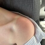 xooos Instagram - Sunburn🏖️