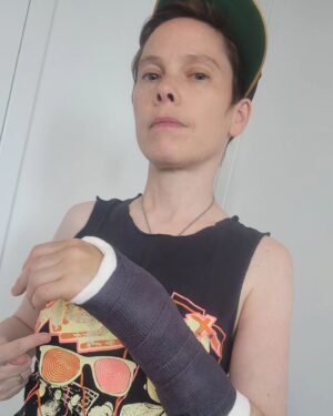 Abigail Savage Instagram - Got a new cast earlier this week. I think it makes me look badass (lol). But seriously, if anyone who's been in a cast before has any advice for me on how to minimize the near constant pain and discomfort, I'm all ears!
