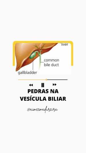 Aimée Madureira Instagram - Pedras da vesícula no microscópio! 🔬
No super detox do @spamariabonitaipanema @spamariabonita @spazziano conseguimos eliminar muitas pedras da vesícula através do processo de desintoxicação único e diferenciado, o que reduz inclusive a necessidade do processo cirúrgico de remoção da vesícula!