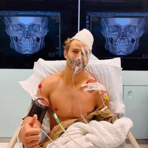 Amanda Leighton Instagram - My best friend... my hero.. you are the toughest man I know! ❤️🙏🏻#Repost @supersagenorthcutt
・・・
Fresh out of surgery...I had 8 fractures and a nine hour intense operation. Feeling blessed for the amazing care and all the support from @onechampionship, my family/friends and fans! My Terminator face is not too Shabby.. 💀“I’ll be back!” Next post is catheter removal😳...stay tuned-JK 😎