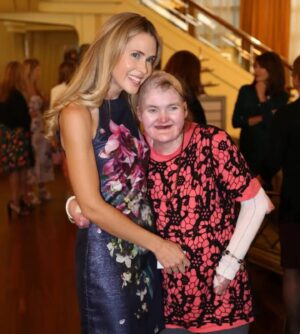 Anna Hutchison Instagram - Hey guys! This is Lisa🤩 She has #EB 🦋 She also has an epic sense of humor, an amazing outlook on life and STORIES😝 I’ve linked Lisa’s story in my bio. Please watch it. Lisa is such an inspiration. To all of you who have donated to @ebresearchaus , THANK YOU 😊 The research being done is helping gorgeous people like Lisa manage their EB. Your donations are making a difference ✨ And with your help we will #CureEB 💕 #ebawarenessweek