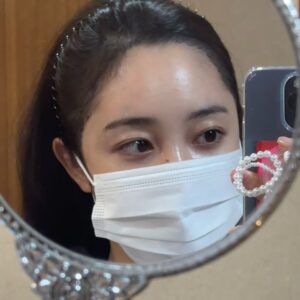 Choi Seol-hwa Instagram - .
이게 뭐라고 삭제 당하뉴..ㅋㅋ
또 삭제 당할까봐 길게는 못쓰고 
병원 문의 다렉주시면 답변 드릴게용😊
정말 정보 공유예요ㅎㅎ 저도 제 돈으로 머리했어용🥹