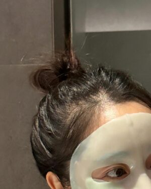 Choi Seol-hwa Instagram - .
이게 뭐라고 삭제 당하뉴..ㅋㅋ
또 삭제 당할까봐 길게는 못쓰고 
병원 문의 다렉주시면 답변 드릴게용😊
정말 정보 공유예요ㅎㅎ 저도 제 돈으로 머리했어용🥹