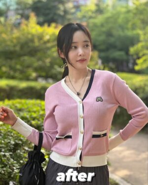 Choi Seol-hwa Instagram - #공구예정 비포 에프터 가져왔어요..!
일부러 포토샵 하나도 안했어요🧸
진쫘 보여주고싶지 않은 모습들이지만..😊
저는 볼꺼짐도 있었고 광대에 살이 많은 편이라 무거워서 쳐짐도 좀 있고 턱 하부에 뭉통거리는 살들도 있었어요!
그래서 소개 받아서 작은얼굴 마사지 받으러 갔다가 하이퍼라는 레이저리프팅 기계가 있는데 울세라와 비슷한 효과가 있는데 훨씬 저렴해서 두가지 관리 한 번이 받고 턱 하부 살과 볼꺼짐 개선돼서 바로 그 다음주에 또 받으러 갔잖아요!

효과가 너무 좋은게 어제 엄마가 제 얼굴 오랜만에 보고 변했다고 하도라고요.
진짜 200% 만족‼️

어제까지 네고 하다가 최대 33%까지 할인 받아왔어요😍😍 너무 다행이에요ㅠ 저에게도🩵
1-2주에 1회씩 무조건 가야겠어요!

위치는 청담동이에요!
황금희 에스테틱 작은얼굴관리 하어퍼 레이저리프팅 6/3~6/7까지 공구하니까 
관리하는거 좋아하시는 분들 무조건 겟하셔야할 타이밍🩵