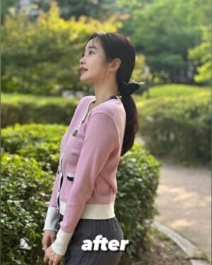 Choi Seol-hwa Instagram - #공구예정 비포 에프터 가져왔어요..!
일부러 포토샵 하나도 안했어요🧸
진쫘 보여주고싶지 않은 모습들이지만..😊
저는 볼꺼짐도 있었고 광대에 살이 많은 편이라 무거워서 쳐짐도 좀 있고 턱 하부에 뭉통거리는 살들도 있었어요!
그래서 소개 받아서 작은얼굴 마사지 받으러 갔다가 하이퍼라는 레이저리프팅 기계가 있는데 울세라와 비슷한 효과가 있는데 훨씬 저렴해서 두가지 관리 한 번이 받고 턱 하부 살과 볼꺼짐 개선돼서 바로 그 다음주에 또 받으러 갔잖아요!

효과가 너무 좋은게 어제 엄마가 제 얼굴 오랜만에 보고 변했다고 하도라고요.
진짜 200% 만족‼️

어제까지 네고 하다가 최대 33%까지 할인 받아왔어요😍😍 너무 다행이에요ㅠ 저에게도🩵
1-2주에 1회씩 무조건 가야겠어요!

위치는 청담동이에요!
황금희 에스테틱 작은얼굴관리 하어퍼 레이저리프팅 6/3~6/7까지 공구하니까 
관리하는거 좋아하시는 분들 무조건 겟하셔야할 타이밍🩵