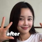 Choi Seol-hwa Instagram - #공구예정 비포 에프터 가져왔어요..! 일부러 포토샵 하나도 안했어요🧸 진쫘 보여주고싶지 않은 모습들이지만..😊 저는 볼꺼짐도 있었고 광대에 살이 많은 편이라 무거워서 쳐짐도 좀 있고 턱 하부에 뭉통거리는 살들도 있었어요! 그래서 소개 받아서 작은얼굴 마사지 받으러 갔다가 하이퍼라는 레이저리프팅 기계가 있는데 울세라와 비슷한 효과가 있는데 훨씬 저렴해서 두가지 관리 한 번이 받고 턱 하부 살과 볼꺼짐 개선돼서 바로 그 다음주에 또 받으러 갔잖아요! 효과가 너무 좋은게 어제 엄마가 제 얼굴 오랜만에 보고 변했다고 하도라고요. 진짜 200% 만족‼️ 어제까지 네고 하다가 최대 33%까지 할인 받아왔어요😍😍 너무 다행이에요ㅠ 저에게도🩵 1-2주에 1회씩 무조건 가야겠어요! 위치는 청담동이에요! 황금희 에스테틱 작은얼굴관리 하어퍼 레이저리프팅 6/3~6/7까지 공구하니까 관리하는거 좋아하시는 분들 무조건 겟하셔야할 타이밍🩵
