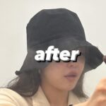 Choi Seol-hwa Instagram - #공구예정 비포 에프터 가져왔어요..! 일부러 포토샵 하나도 안했어요🧸 진쫘 보여주고싶지 않은 모습들이지만..😊 저는 볼꺼짐도 있었고 광대에 살이 많은 편이라 무거워서 쳐짐도 좀 있고 턱 하부에 뭉통거리는 살들도 있었어요! 그래서 소개 받아서 작은얼굴 마사지 받으러 갔다가 하이퍼라는 레이저리프팅 기계가 있는데 울세라와 비슷한 효과가 있는데 훨씬 저렴해서 두가지 관리 한 번이 받고 턱 하부 살과 볼꺼짐 개선돼서 바로 그 다음주에 또 받으러 갔잖아요! 효과가 너무 좋은게 어제 엄마가 제 얼굴 오랜만에 보고 변했다고 하도라고요. 진짜 200% 만족‼️ 어제까지 네고 하다가 최대 33%까지 할인 받아왔어요😍😍 너무 다행이에요ㅠ 저에게도🩵 1-2주에 1회씩 무조건 가야겠어요! 위치는 청담동이에요! 황금희 에스테틱 작은얼굴관리 하어퍼 레이저리프팅 6/3~6/7까지 공구하니까 관리하는거 좋아하시는 분들 무조건 겟하셔야할 타이밍🩵