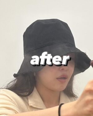 Choi Seol-hwa Instagram - #공구예정 비포 에프터 가져왔어요..!
일부러 포토샵 하나도 안했어요🧸
진쫘 보여주고싶지 않은 모습들이지만..😊
저는 볼꺼짐도 있었고 광대에 살이 많은 편이라 무거워서 쳐짐도 좀 있고 턱 하부에 뭉통거리는 살들도 있었어요!
그래서 소개 받아서 작은얼굴 마사지 받으러 갔다가 하이퍼라는 레이저리프팅 기계가 있는데 울세라와 비슷한 효과가 있는데 훨씬 저렴해서 두가지 관리 한 번이 받고 턱 하부 살과 볼꺼짐 개선돼서 바로 그 다음주에 또 받으러 갔잖아요!

효과가 너무 좋은게 어제 엄마가 제 얼굴 오랜만에 보고 변했다고 하도라고요.
진짜 200% 만족‼️

어제까지 네고 하다가 최대 33%까지 할인 받아왔어요😍😍 너무 다행이에요ㅠ 저에게도🩵
1-2주에 1회씩 무조건 가야겠어요!

위치는 청담동이에요!
황금희 에스테틱 작은얼굴관리 하어퍼 레이저리프팅 6/3~6/7까지 공구하니까 
관리하는거 좋아하시는 분들 무조건 겟하셔야할 타이밍🩵