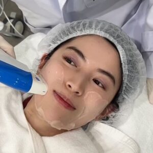 Chollatorn Pratchyaroongroj Instagram - Ultraformer MPT ที่ @labxclinic ดีมาก ทำแล้วผิวหน้ายกกระชับ กระตุ้นการสร้างคอลลาเจน รู้สึกผิวเฟิร์มขึ้น กรอบหน้ามาเลยค่า 🌈