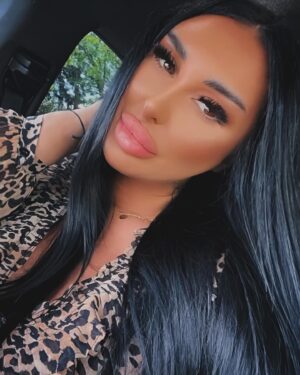 Dana Badea Instagram - My lips @dr.youssef_majed ❤️❤️❤️