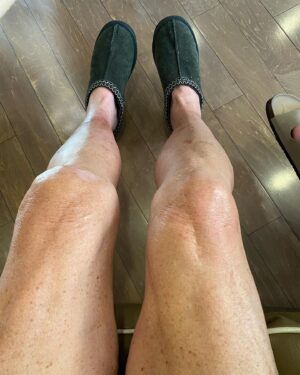 Dot-Marie Jones Instagram - I haven’t post anything about my knee replacement. I know my girl @bridgettcjones had but wanted to as well. My knee was a mess and this was the 8th surgery on my left one. I think I got my miles out of it. 9-12-23 was surgery! Have had some very bad days but slowly getting better! Thank you @bridgettcjones for being an amazing nurse and taking good care of me . I love you forever and always.  I made that fancy cup and stuff holder for my Walker!!! Jealous 😉love y’all! I’ll keep y’all up to date! Today is day 8. Ya don’t count the day ya had the surgery cause ya don’t!!!