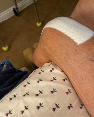Dot-Marie Jones Instagram - I haven’t post anything about my knee replacement. I know my girl @bridgettcjones had but wanted to as well. My knee was a mess and this was the 8th surgery on my left one. I think I got my miles out of it. 9-12-23 was surgery! Have had some very bad days but slowly getting better! Thank you @bridgettcjones for being an amazing nurse and taking good care of me . I love you forever and always.  I made that fancy cup and stuff holder for my Walker!!! Jealous 😉love y’all! I’ll keep y’all up to date! Today is day 8. Ya don’t count the day ya had the surgery cause ya don’t!!!