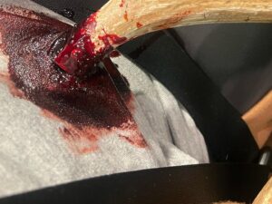 Emma Hunton Instagram - TW: FAKE BLOOD! 

So stoked to have been on this weeks episode of @station19 before this weeks episode of @goodtrouble!! This cast and crew are badass and I feel very lucky and humbled to have been able to play with them. GIGANTIC thank you to @michaelmedicola and @thepeterpaige for thinking of me. I will always do anything you ask. 🖤🦌