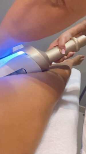 Esmeralda Moya Instagram - A parte de una dieta sana-saludable y deporte, también me hago mis tratamientos corporales para completar mi rutina corporal. Esta vez es la segunda vez, mi segundo año consecutivo haciéndome el tratamiento @endospheresespana_official , ahora es más avanzado, tercera generación llamado Endospheres Evolution el cual los resultados son más rápidos y duraderos. Con este tratamiento consigo tonificar y remodelar la silueta gracias a sus esferas de silicona que actúan sobre el músculo y ayudan a reducir celulitis, y además, no es nada invasivo y 100% seguro.
 
#encolaboracioncon #endospheres #evolution #tratamientocorporal #bodyshaping #cuidarse #publi