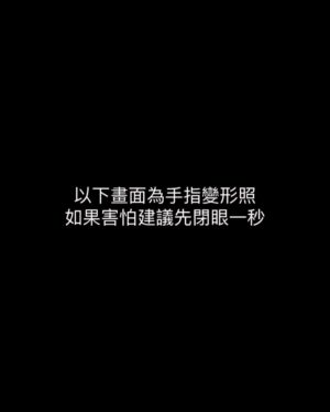 Fang Wu Instagram - 開場畫面如果害怕建議先閉眼

這是今年三月老天爺送我的生日禮物
我的小指骨折得要固定等待傷口癒合
暫時不能衝浪 不能激烈運動 
不能彈吉他…
大約一個月後開始了看似無止盡的復健

我才意識到只是短短一個月不動
就能沾黏成這樣
那身體呢

一直在自修瑜伽的我 
為了想了解更多

第一次一個人開車到台東
第一次一個人天剛亮去都歷衝浪
第一次清晨瑜伽團練
第一次開始對食療有了認識
第一次練習幫別人理療
第一次可以不吹冷氣一週
第一次跟大自然生活一週
第一次拿到 #阿育吠陀 療癒初級師資
YACEP美國瑜伽聯盟60hurs

做這隻影片只是想和你們分享
今年為什麼開始身心靈旅程的原因
自己也想做個紀錄
在未來任何脆弱的時候都能再次提醒自己

每段旅程的失去和得到
都是一份禮物