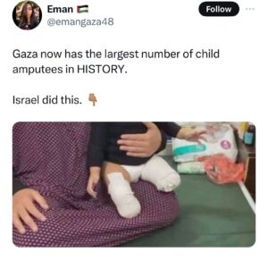 Haley Webb Instagram - Gaza has the highest number of child amputees in history 💔 Children are becoming amputees before they even get the chance to walk, while they are still in diapers! Innocent babies are losing limbs and they will have to endure life-altering pain. Israel is doing this, a morally bankrupt, corrupt and  genocidal regime, while the world just watches. 

#palestinianpublichealth #ceasefirenow🇵🇸
