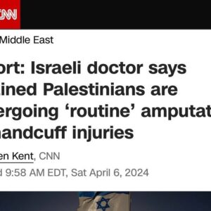 Haley Webb Instagram - A doctor at Israel’s Sde Teiman field hospital described ‘deplorable conditions’ and ‘routine’ amputations due to handcuff injuries at a field hospital for detained Palestinians. The use of handcuffs with excessive force that leads to such severe injuries underscores a blatant disregard for human rights. These handcuffs can cause excruciating pain, nerve damage, and tissue necrosis, ultimately resulting in irreversible damage that necessitates amputation. The thought of amputation due to such injuries is horrifying. 

In a letter addressed to Israel’s attorney general and defense and health ministers, the doctor expressed concerns that the conditions at Sde Teiman field hospital compromise inmates’ health and violate medical ethics. The doctor stated, ‘Just this week, two prisoners had their legs amputated due to handcuff injuries, which unfortunately is a routine event.’

The doctor’s letter highlighted that inappropriate care at the detention facility has led to ‘complications and sometimes even in the patient’s death,’ implicating the medical teams and authorities in the violation of Israeli law.

According to Haaretz, the doctor further described that ‘inmates are fed through straws, defecate in diapers and are held [in] constant restraints,’ actions that violate medical ethics and the law. This is deeply distressing.

We must demand accountability and international intervention to end these atrocities and uphold human dignity.

#palestinianpublichealth #freepalestine