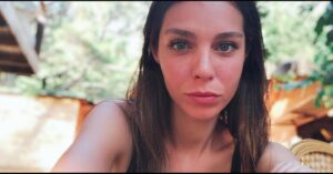Hazal Adıyaman Instagram - Açık tenliler için kızarma vakti. ☀️🌿🦎